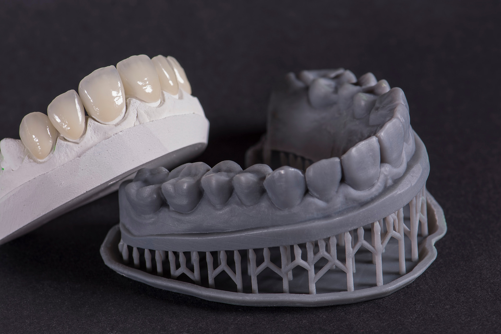 3D Printing in Dentistry: Custom Crowns and Bridges in Record Time