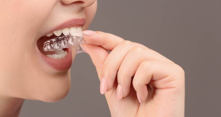 The Impact of Dental Occlusion on Athletic Performance