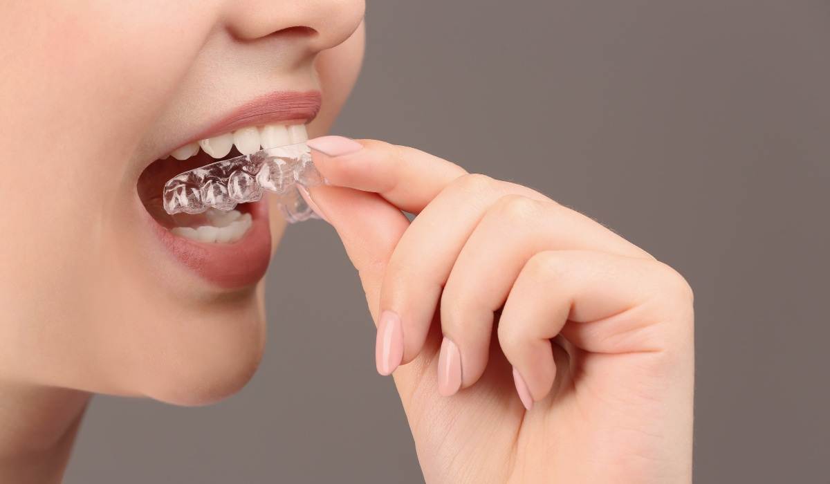 The Impact of Dental Occlusion on Athletic Performance