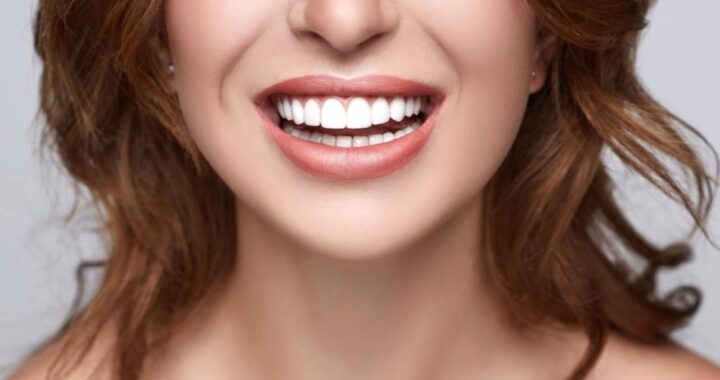Is a Porcelain Veneer Right for You? Benefits, Process & Results